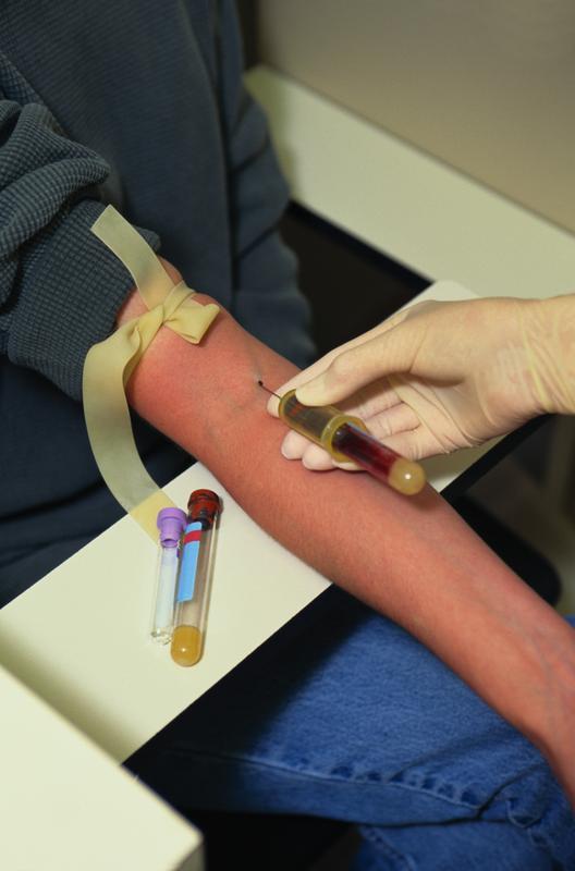 Phlebotomy Training Online or Hands On 2 Days, Certificate Program